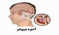 پادکست ـ طرح تحقیقاتی آنالیز بیان ژن های مسیر نکروپتوز در بیماران مبتلا به آدنوم هیپوفیز