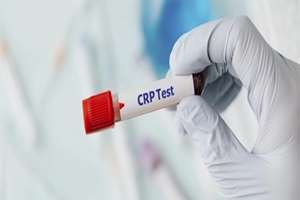   پادکست _ بررسی ارزش تشخیصی نسبت CRP به آلبومین در پیشبینی ایسکمی میوکارد با کمک سینتی گرافی پرفیوژن میوکارد